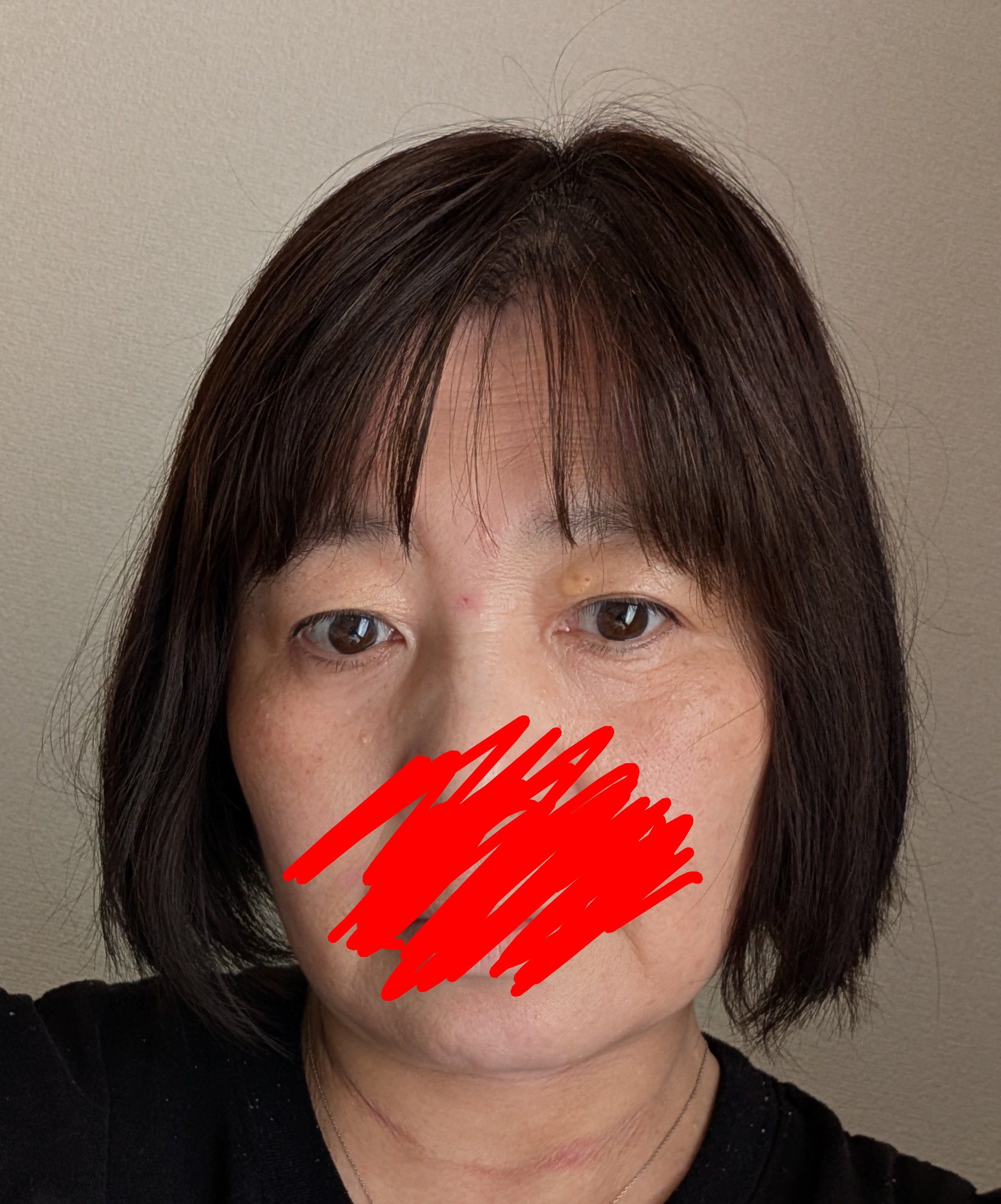 くるみ
